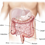 Colonic Irrigation – What Is It? Colonic irrigation