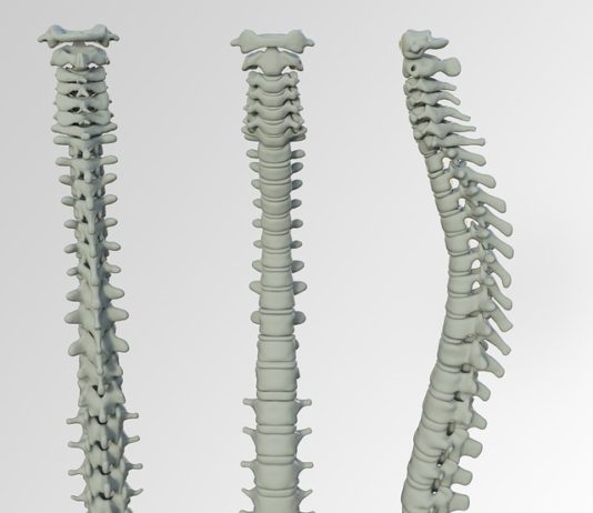 Disc Injuries Disc Injuries