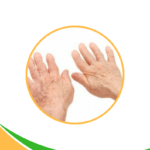 Holistic Solutions for Arthritis