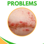 Holistic Solutions for Skin Problems