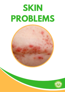 Holistic Solutions for Skin Problems