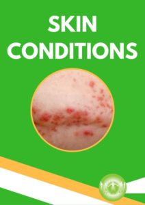 Health Conditions - Skin Conditions