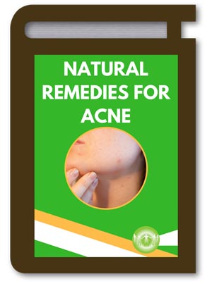 Natural Remedies for Acne