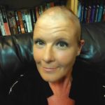 alopecia