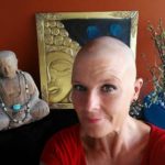 alopecia