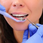 How To Choose The Right Dental Clinic For Proper Oral Care Proper Oral Care
