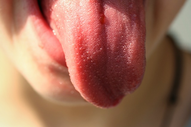 burnt tongue