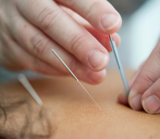 Pain Management, Holistic Therapies: From Acupuncture To CBD Pain Management
